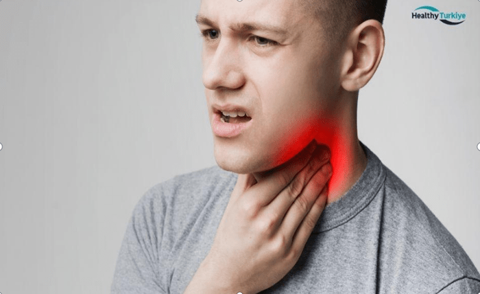 Minimally Invasive Tonsillectomy in Turkey: A Comprehensive Guide Screenshot 3